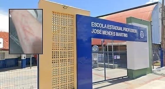 imagem
