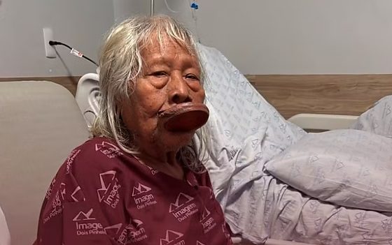 Aos 94 anos, cacique Raoni enfrenta câncer e recebe cuidados paliativos em Mato Grosso